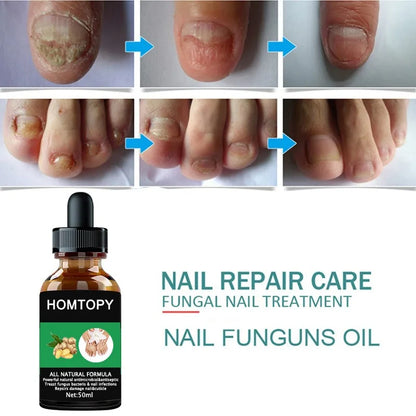 7 Days Nail Fungal Treatment Serum Oil Foot Toe Nail Fungus Removal Serum Repair Onychomycosi Anti Infection Uñas Care Products
