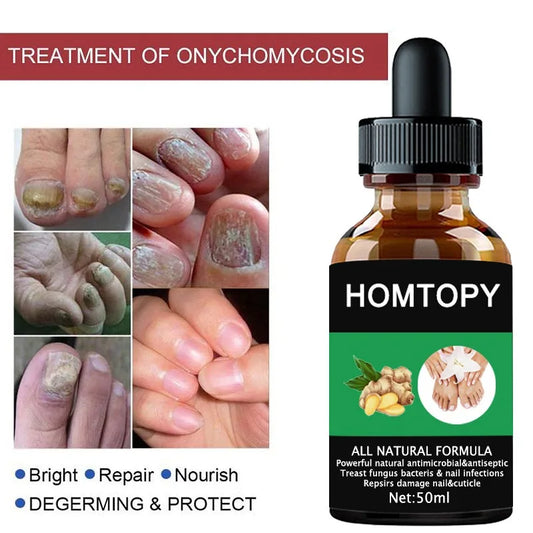 7 Days Nail Fungal Treatment Serum Oil Foot Toe Nail Fungus Removal Serum Repair Onychomycosi Anti Infection Uñas Care Products