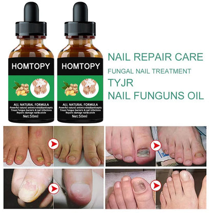 7 Days Nail Fungal Treatment Serum Oil Foot Toe Nail Fungus Removal Serum Repair Onychomycosi Anti Infection Uñas Care Products