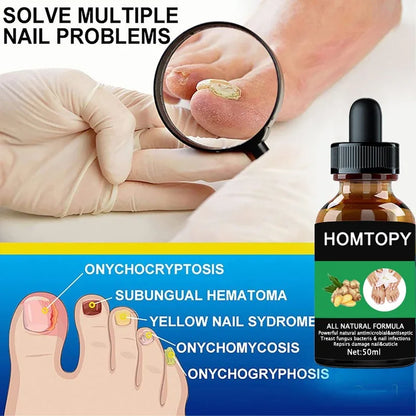 7 Days Nail Fungal Treatment Serum Oil Foot Toe Nail Fungus Removal Serum Repair Onychomycosi Anti Infection Uñas Care Products