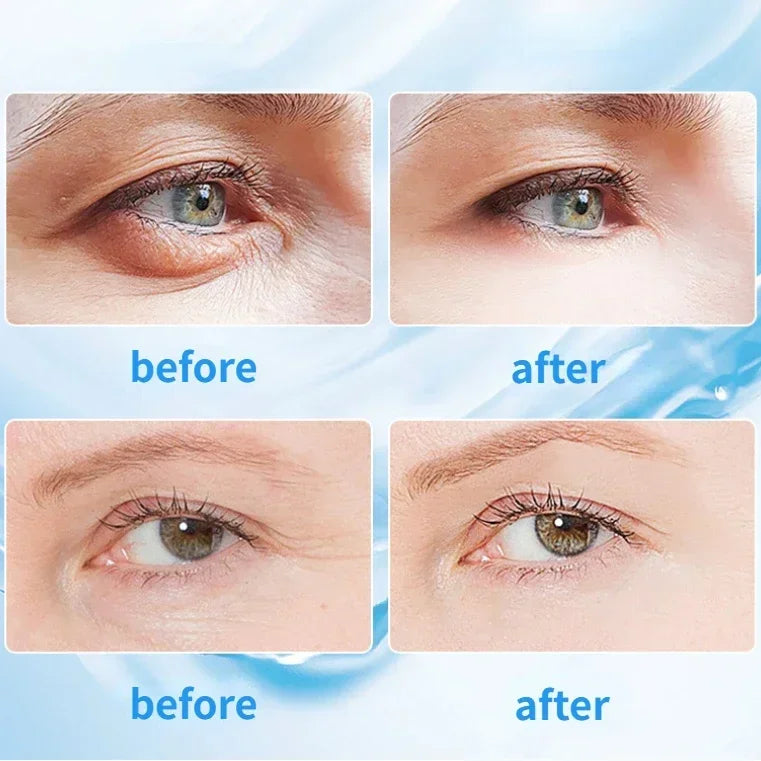 Nano Eye Care Device - Eye Massager with Steam Atomization, Spray for Dry Eyes, Hydrating & Nourishing