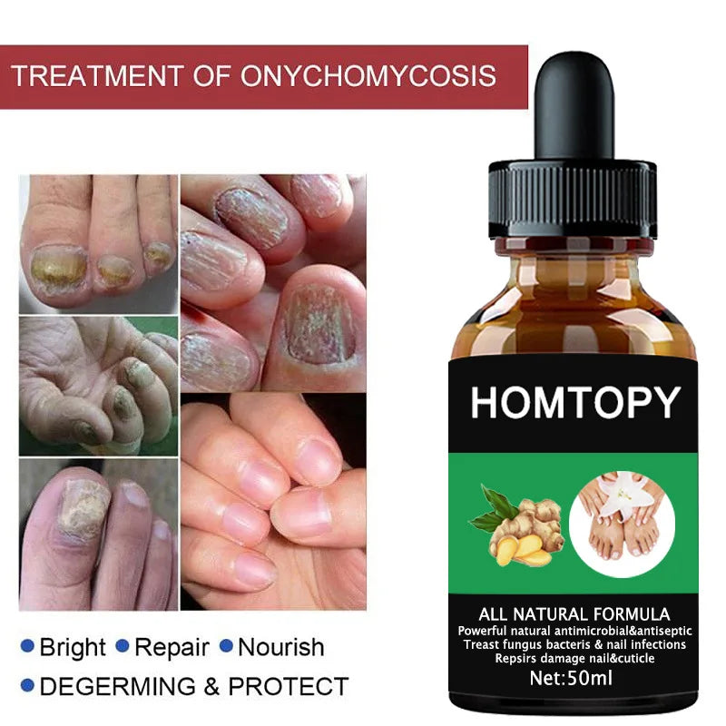 7 Days Nail Fungal Treatment Serum Oil Foot Toe Nail Fungus Removal Serum Repair Onychomycosi Anti Infection Uñas Care Products