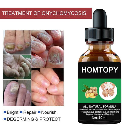 7 Days Nail Fungal Treatment Serum Oil Foot Toe Nail Fungus Removal Serum Repair Onychomycosi Anti Infection Uñas Care Products